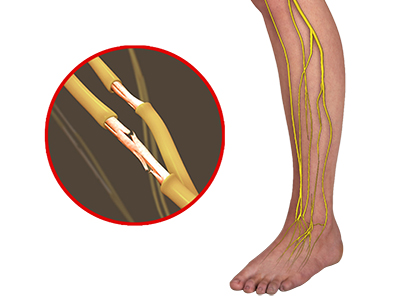 Advanced Pain Management Intervention