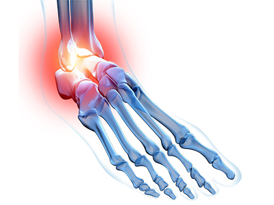 Ankle Pain