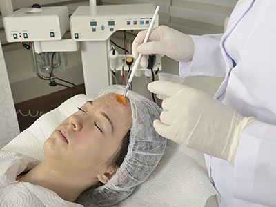 Chemical Peels