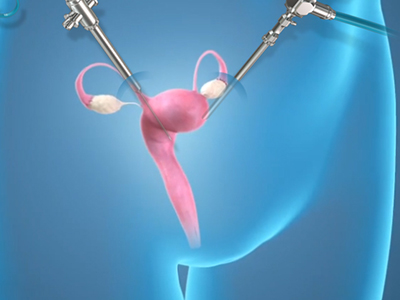 Minimally Invasive Gynecologic Surgery