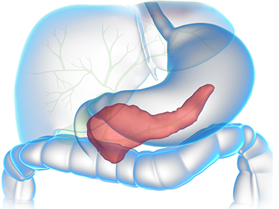 Pancreatic Surgery