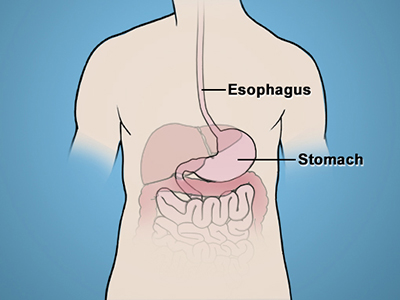Upper Gastrointestinal Disease